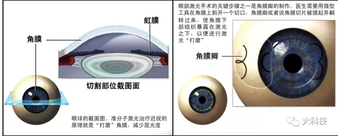 激光能让人全身美白吗,激光能照射到皮肤里面吗