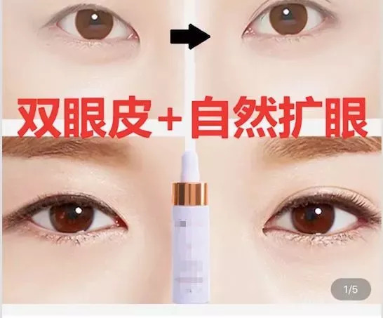 为了变美年轻人们到底有多拼,韩国女孩为了变美能有多拼全集