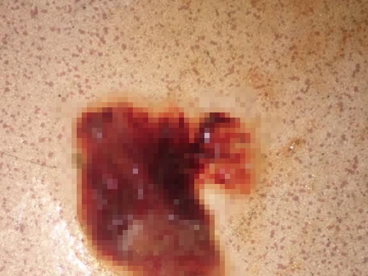 狗狗突然呕吐是什么原因怎么治疗,狗狗呕吐的原因和治疗策略