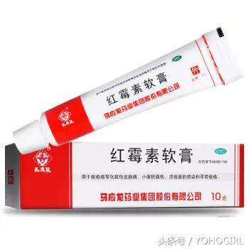 头皮和身上长痘,头皮油脸长痘