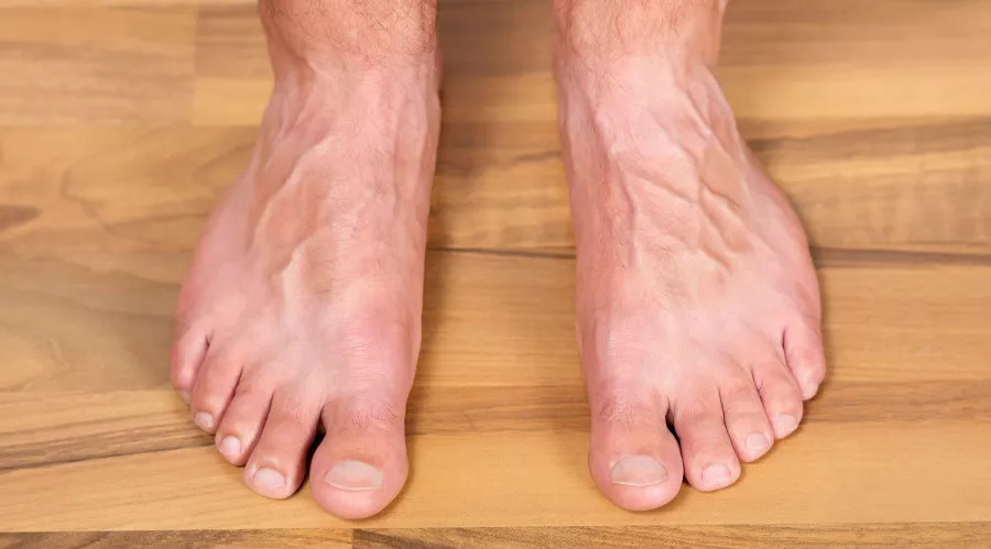 血管堵不堵从这些地方一看就知道,血管堵不堵两个动作就知道