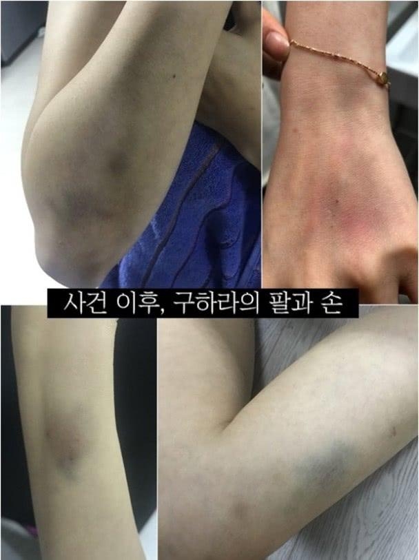 韩国女生被男人打,韩国女子被男友暴打