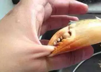 杭州大妈手指红肿、体温38!吃蟹季,这些事儿你需要知道!