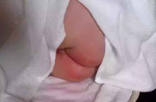 婴儿屁屁霜有必要买吗,品牌婴儿屁屁霜