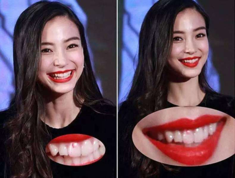 涂口红不粘牙小技巧,厚唇涂口红的小妙招