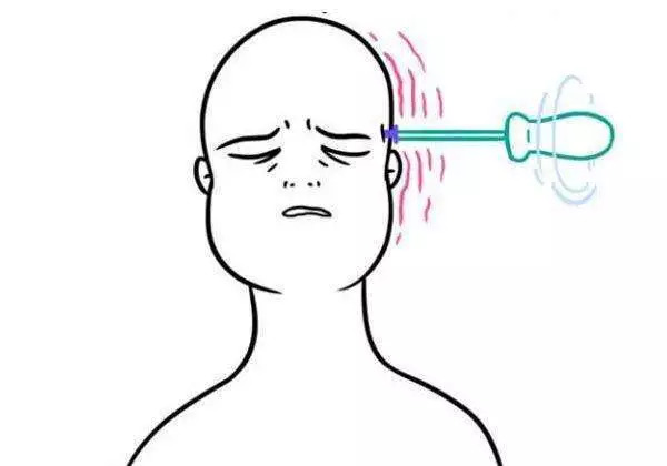 偏头痛要做手术吗,偏头痛心脏手术