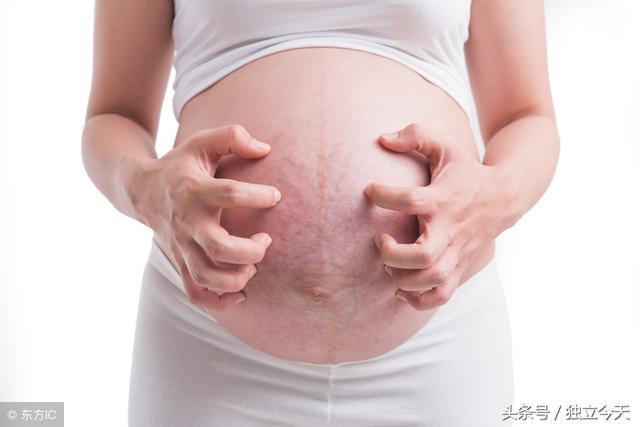 33岁怀孕第一胎需要注意什么,33岁长妊娠纹的概率