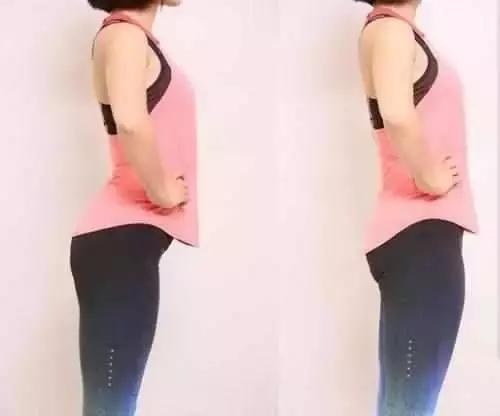 一招解决腿不直的方法,腿不直怎么1个动作矫正