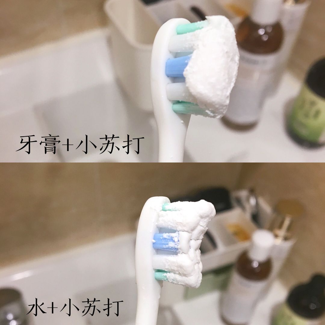 牙齿美白终极指南,白牙超级美白