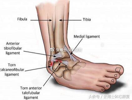 踝关节保守治疗康复训练方法,踝关节损伤的康复训练方法有哪些