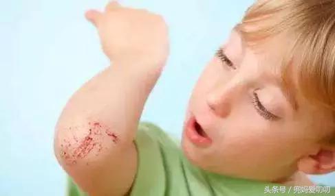宝宝擦伤涂碘伏？吃药加糖水？这些误区不避免，可能会毁了孩子！