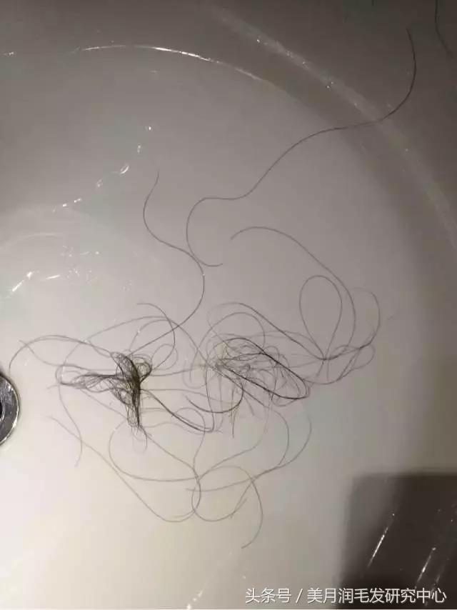 超可怕！关晓彤、奶茶妹妹式女生初老8个症状，你中了几个？