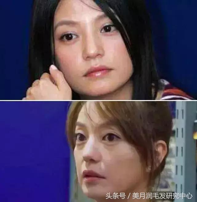 超可怕！关晓彤、奶茶妹妹式女生初老8个症状，你中了几个？