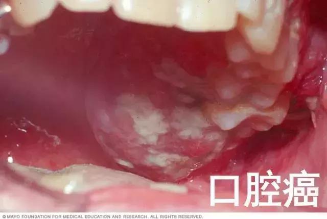 “上海第一美女”自杀，这一点却被忽略了