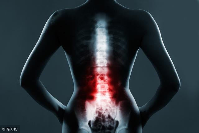 卧床对腰椎间盘突出治疗有用吗,卧床休息可以治疗腰间盘突出吗