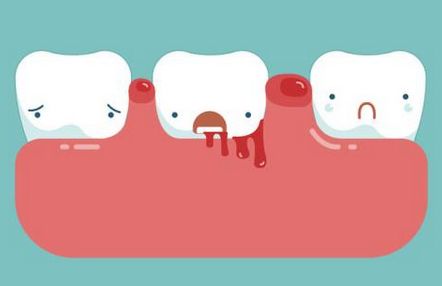 家用美容仪真的能紧致肌肤吗,家用美容仪真的能提拉紧致吗