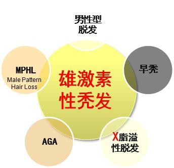 5个原因导致男人脱发,雄激素性脱发能治吗