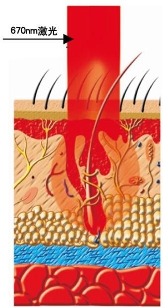 5个原因导致男人脱发,雄激素性脱发能治吗