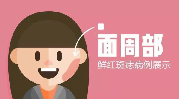 刚刚出生婴儿脸上长了肉痣怎么办,8个月宝宝脸上长雀斑样痣