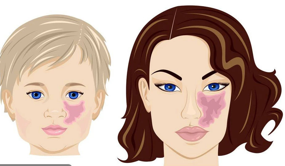 刚刚出生婴儿脸上长了肉痣怎么办,8个月宝宝脸上长雀斑样痣