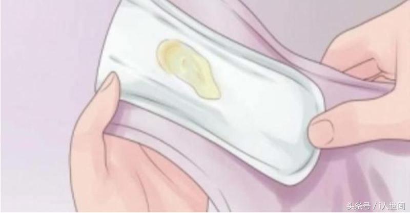 内裤老是有异物怎么回事,内裤上出现什么情况不正常