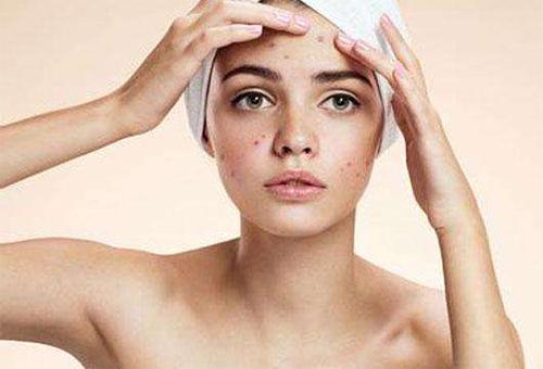 中科院祛痘印洗面奶,梧桐洗面奶