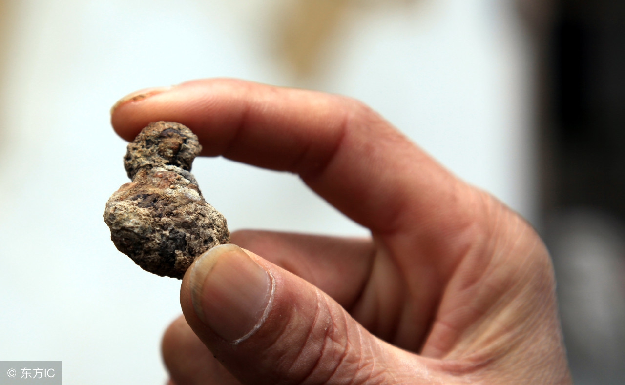 百年大医家系列|国医大师朱良春：治泌尿系结石，看老夫手段