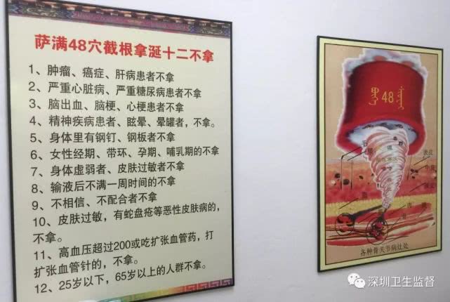 董氏奇穴治脑梗,陕西萨满48穴截根疗法