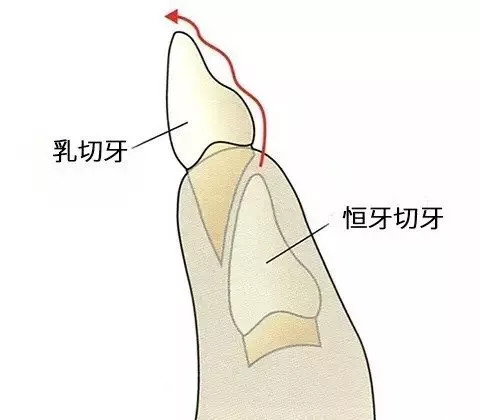 要想长命百岁就得改掉这些坏毛病,关于孩子换牙的8大问题