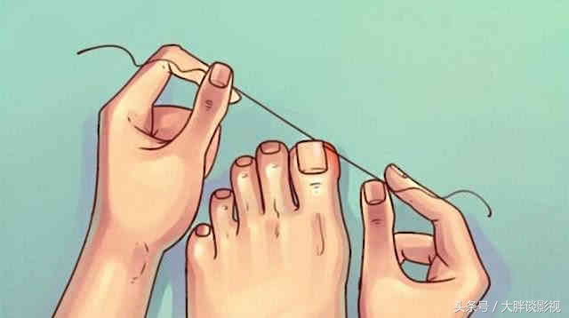 甲沟炎长出来的趾甲很难看,甲沟炎把趾甲剪了还是疼