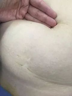 90岁老人突然来大姨妈,70多老太太突然来大姨妈怎么回事