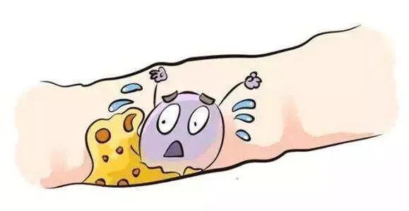 2岁宝宝耳朵化脓了,2岁宝宝耳朵流脓表现