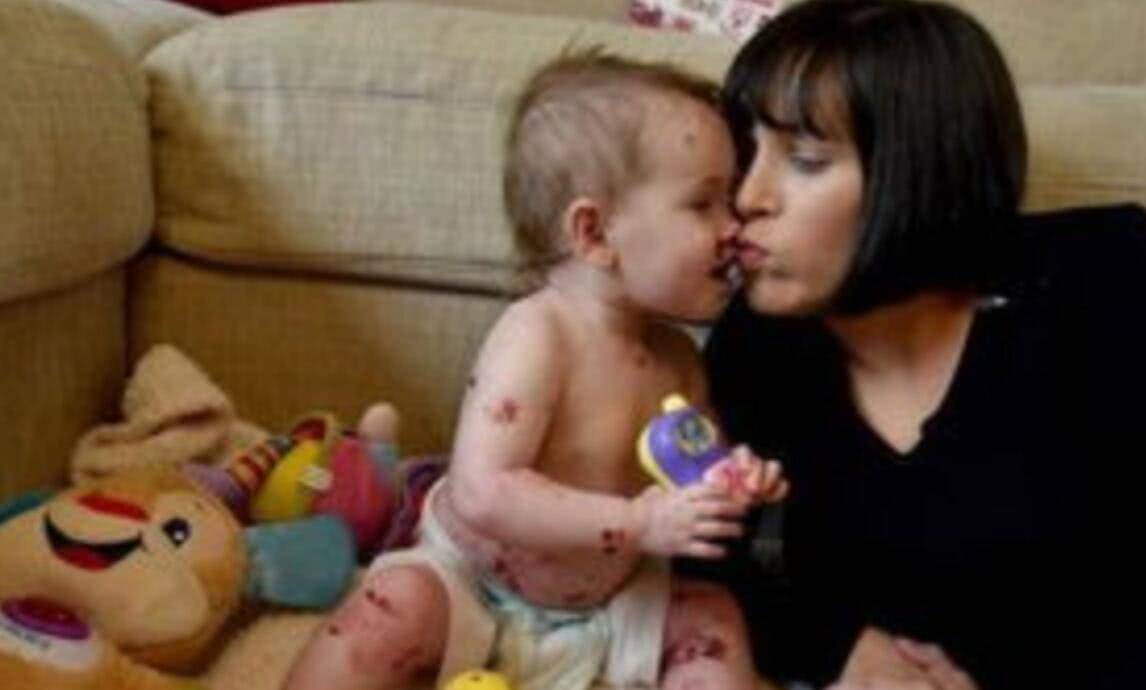 4岁宝宝总说身上痒是怎么回事,4岁小孩说身上痒怎么回事