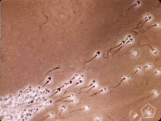 人类精子变少,40年男性精子数量