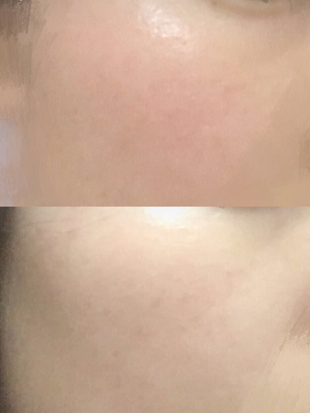 万年面膜,万年抗衰老面膜