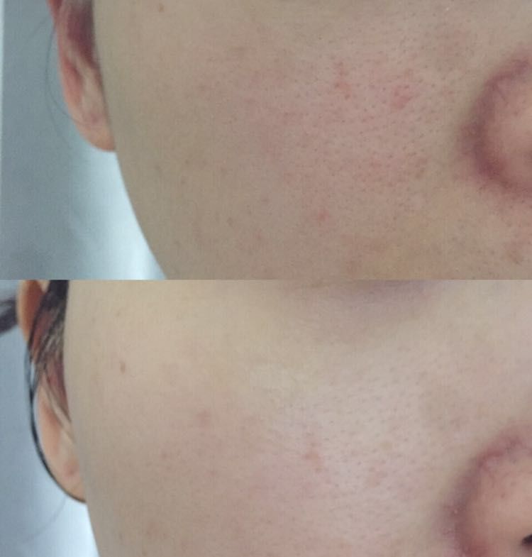 万年面膜,万年抗衰老面膜