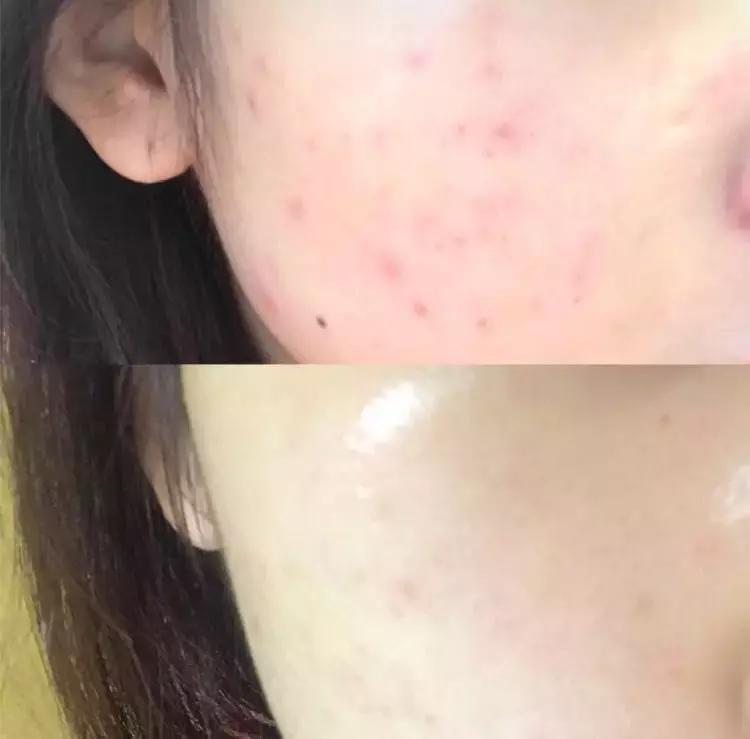 万年面膜,万年抗衰老面膜