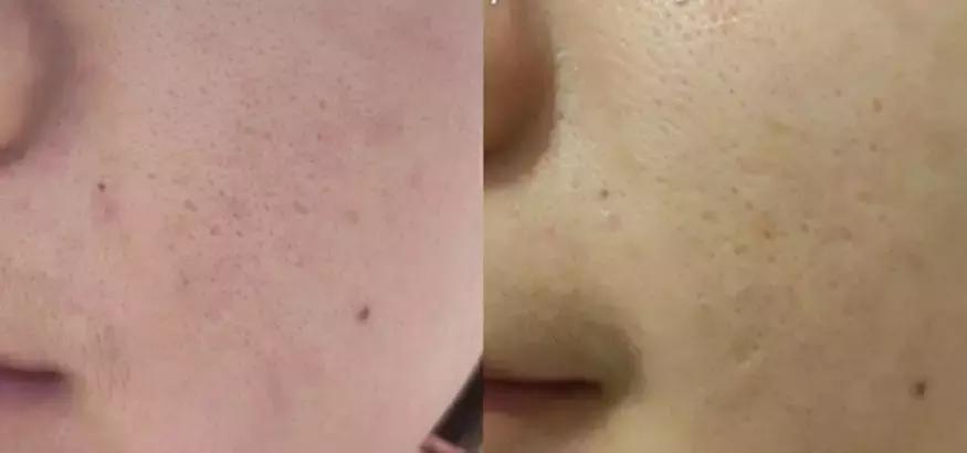 万年面膜,万年抗衰老面膜