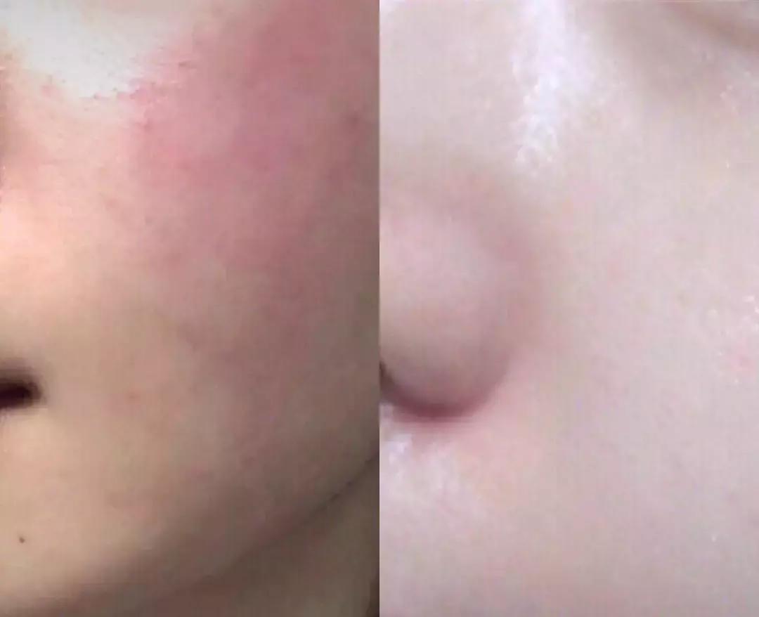 万年面膜,万年抗衰老面膜