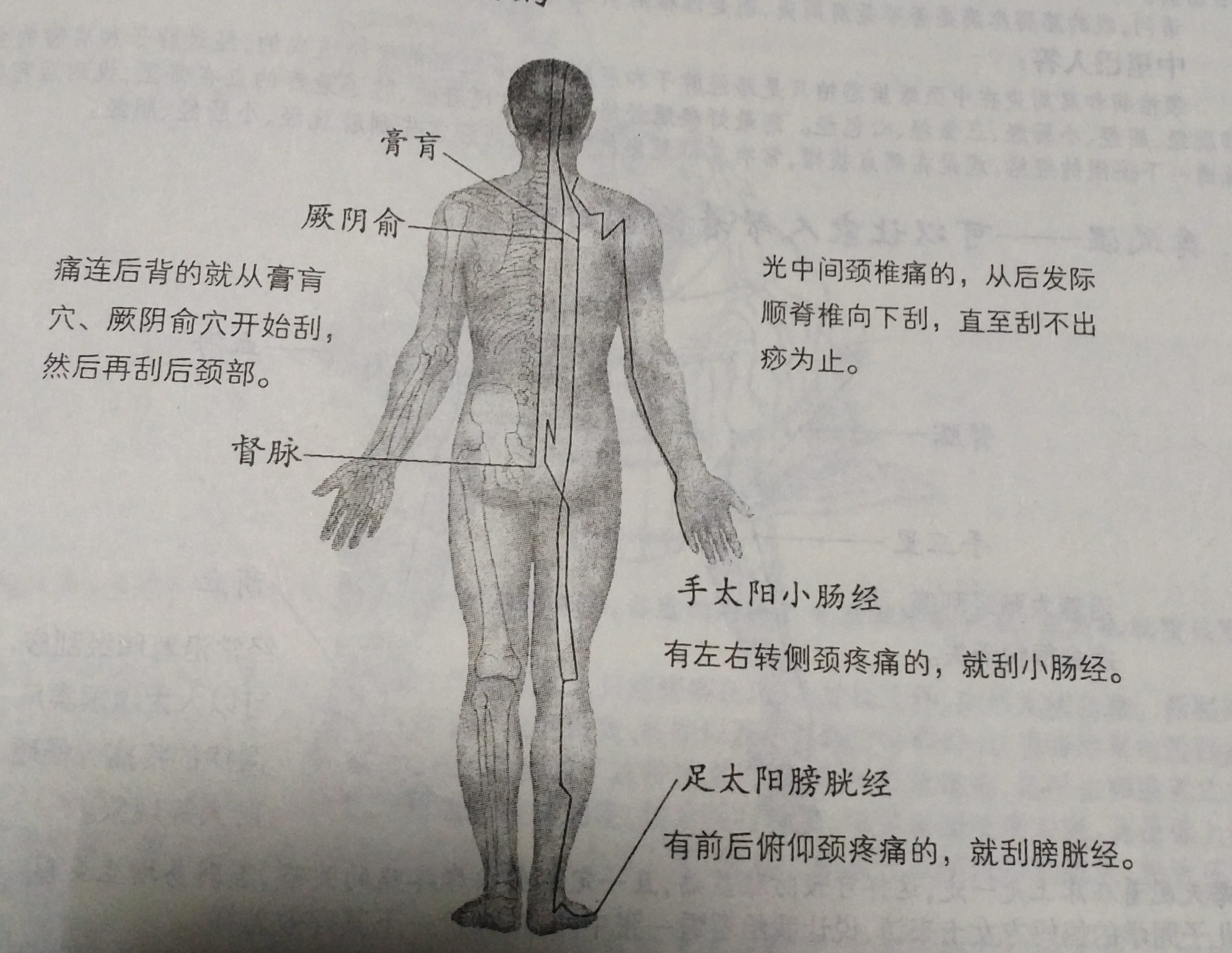 脊椎病最好治疗方案,脊椎病的最佳治疗方案