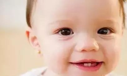 牙龈出血的治疗小偏方,牙龈出血多跟吐血似的