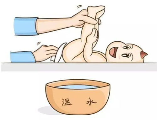 新生宝宝怎么护理不红屁屁,二个月宝宝红屁屁怎么护理
