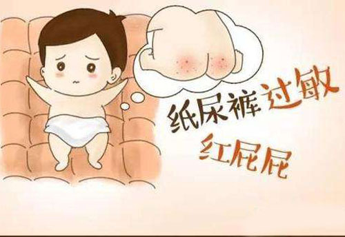 新生宝宝怎么护理不红屁屁,二个月宝宝红屁屁怎么护理