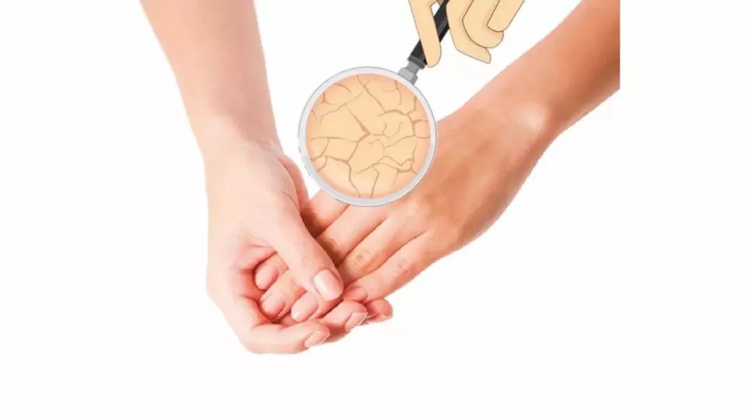 手干、脱皮都赖天气?没那么简单!(内附一周专家坐诊表)