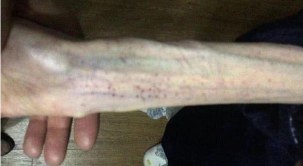 21岁女孩减肥只剩50斤,19岁花季少女减肥从88减到55