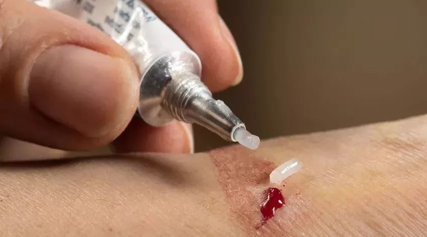 宝宝和妈妈都适合的外用药，几块一支的它功能超出你想象