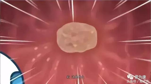 胶囊机器人胃镜可以检查哪些,黑科技胃镜胶囊和普通胃镜