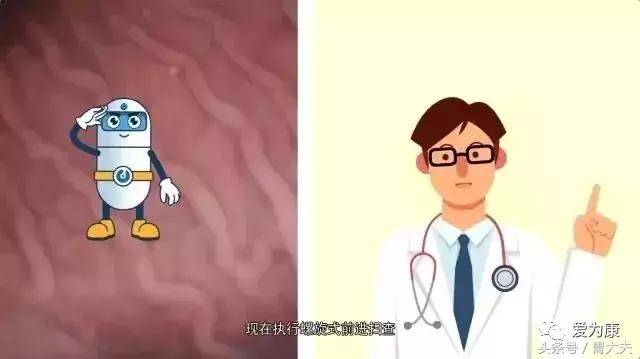 胶囊机器人胃镜可以检查哪些,黑科技胃镜胶囊和普通胃镜