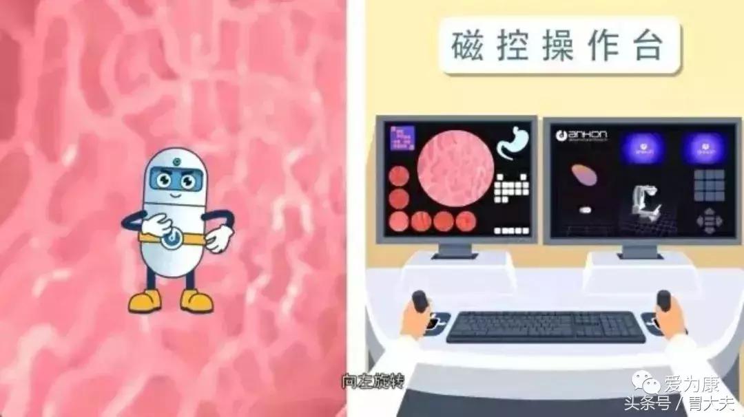 胶囊机器人胃镜可以检查哪些,黑科技胃镜胶囊和普通胃镜