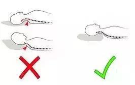 一觉醒来脖子僵得不能动,一觉醒来脖子全是汗怎么回事